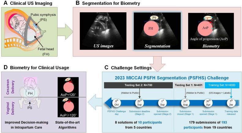 图2. 分娩监测方法提出的总体流程 配图2